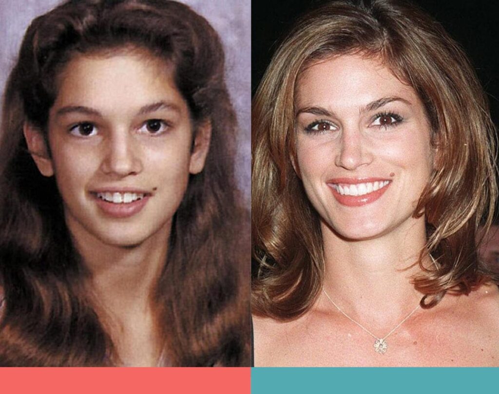 Cindy Crawford with braces