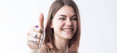 special occasions with braces