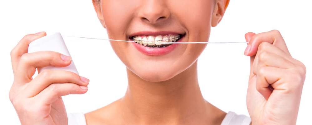 استفاده از نخ دندان برای بریس ارتودنسی