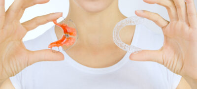Removeable Retainers