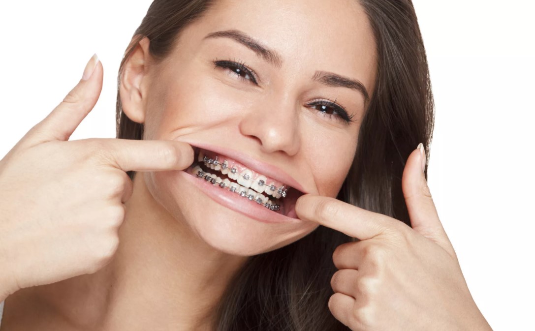 Orthodontics Australia | Periodontal Disease and Orthodontic Braces