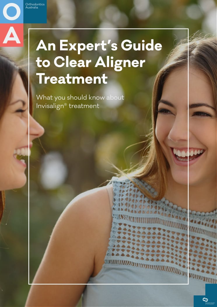 Guide to Clear Aligners