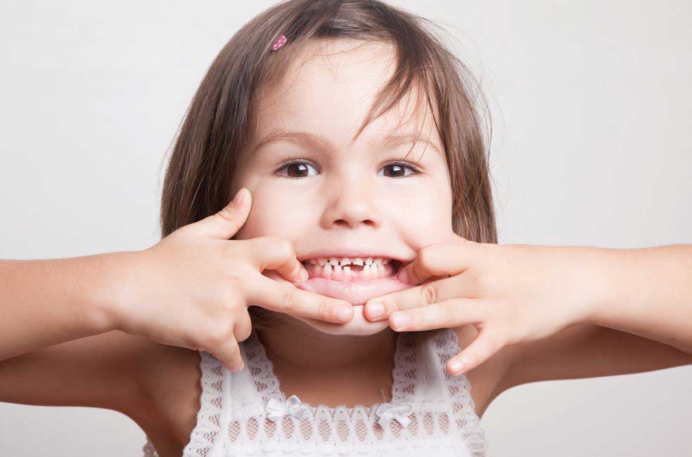Does it matter if my child has crooked baby teeth?