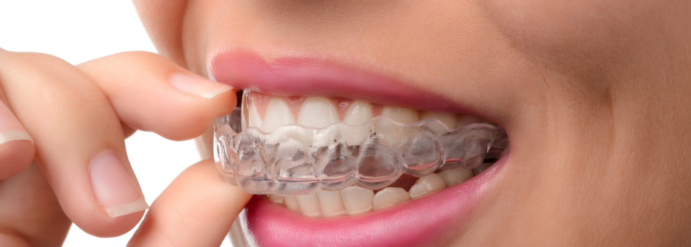 How to care for your retainer?