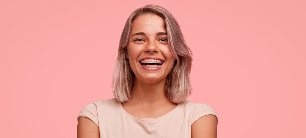 The Best Options To Straighten Your Front Teeth Only