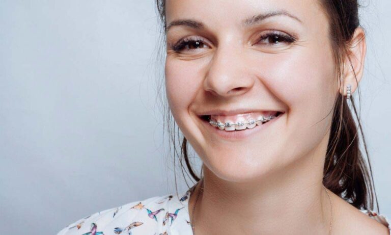 Orthodontics Australia | How to Get Rid of Puffy Gums with Braces