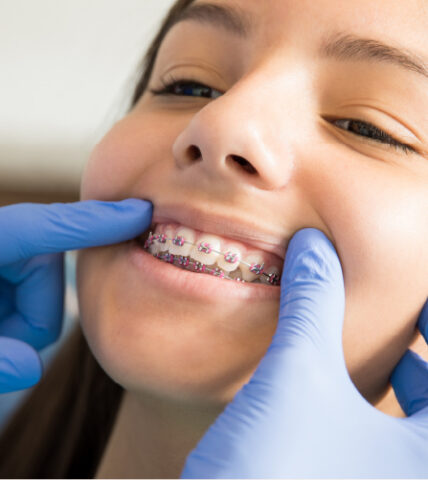 How Rubber Bands For Braces Help Align Your Teeth During Treatment? -  Dental Health Clinic