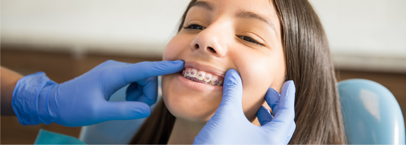 Orthodontics Australia  Elastics For Braces: Rubber Bands in Orthodontics