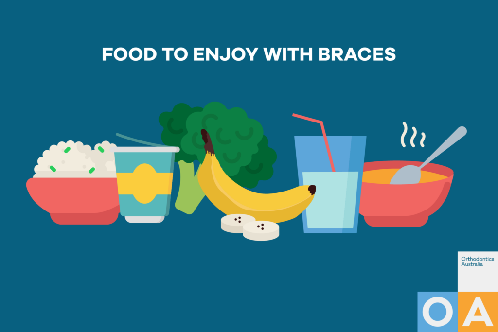 Foods you can and can’t eat with braces