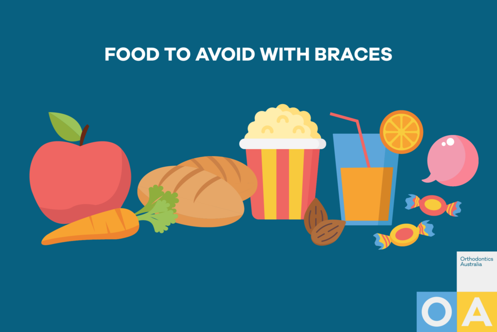 Foods you can and can’t eat with braces