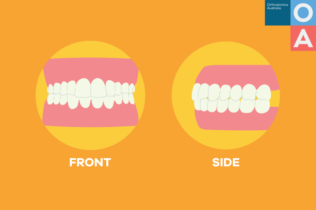 Are your teeth supposed to touch when you sleep?