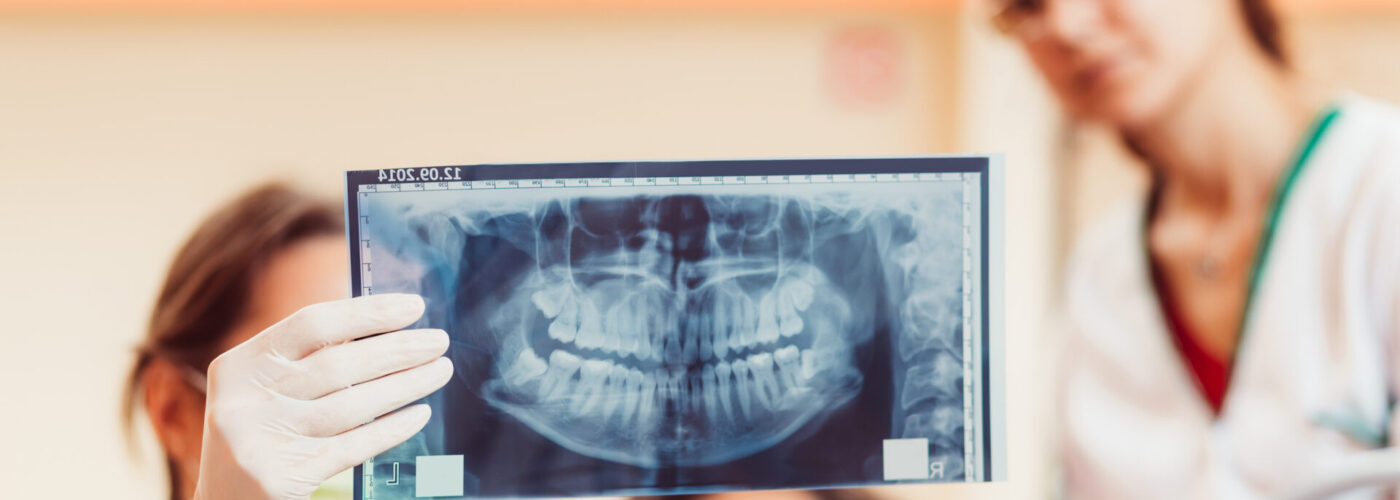 Jaw surgery and braces  