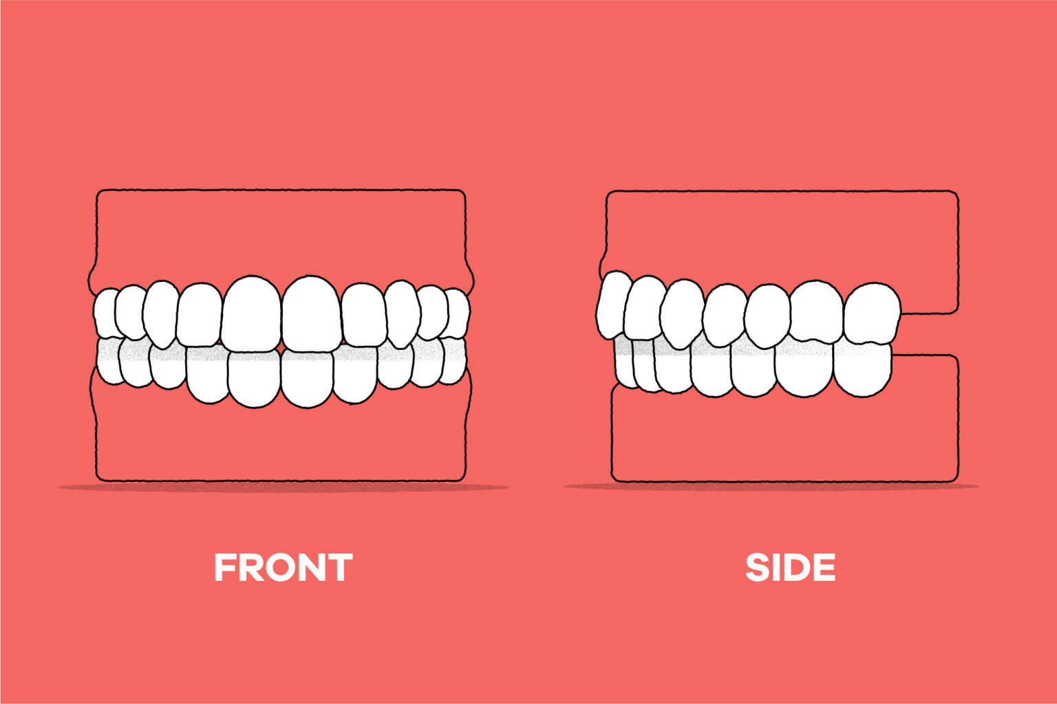 Orthodontics Australia How are teeth supposed to rest?