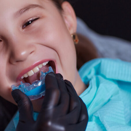 Mouthguard for braces