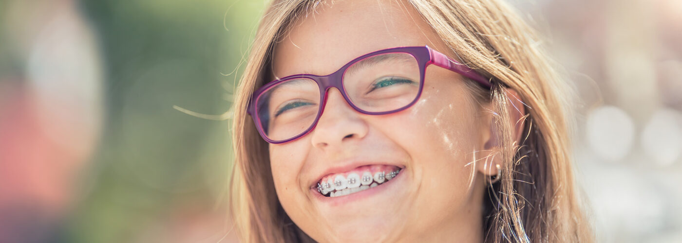 Power Chain Braces: What You Need to Know