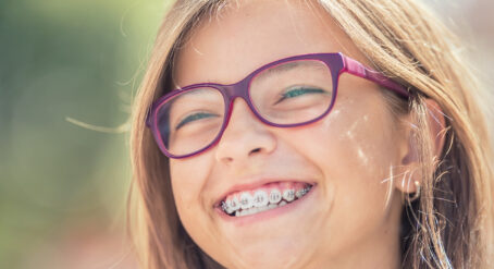 Power Chain Braces: What You Need to Know