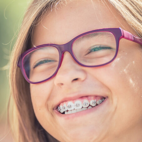 Power Chain Braces: What You Need to Know